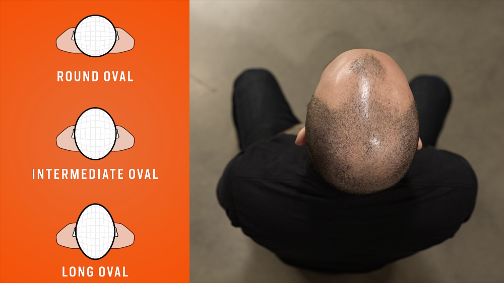 determining your head shape